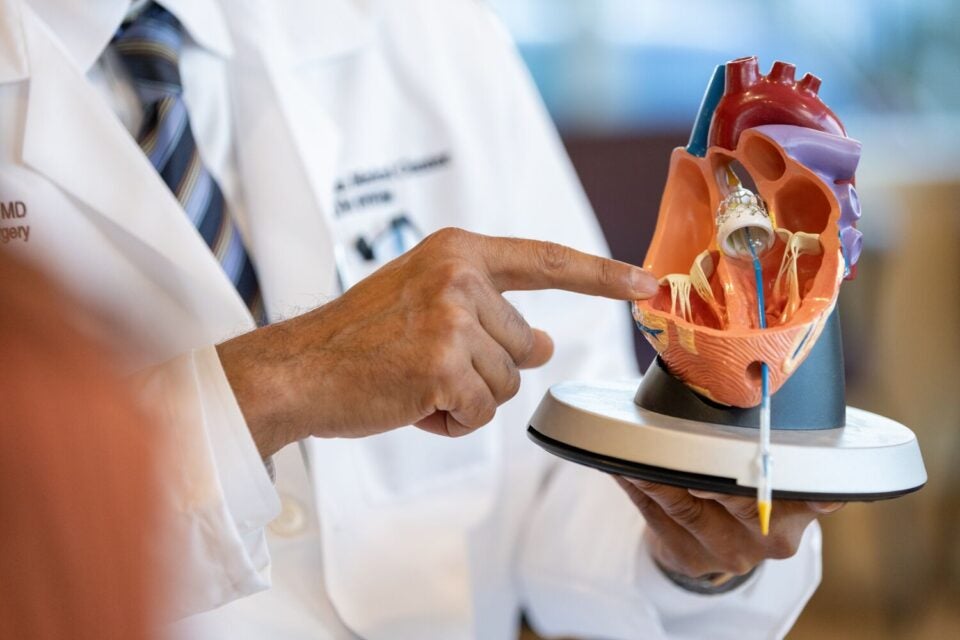 Close-up of a hand (it’s the hand of Dr. Arvind Agnihotri, cardiac surgeon at BMC Brighton) pointing to a spot on a plastic model heart
