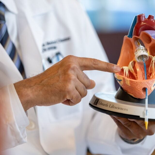 Dr Agnihotri points at life-like heart diagram.